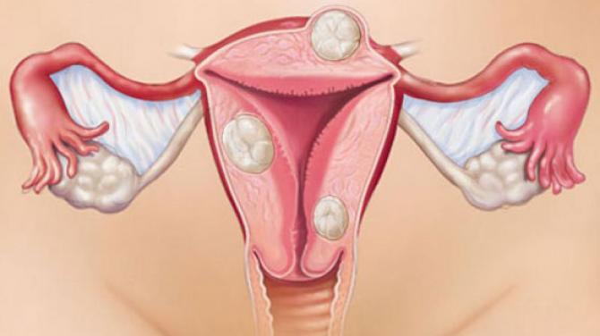 Болит внизу живота у женщины: возможные причины, сопутствующие симптомы